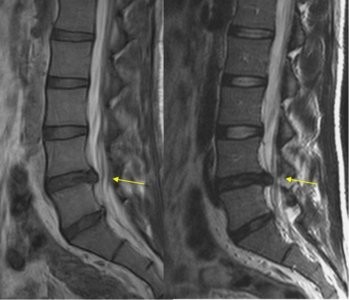 Imagen resonancia magnetica